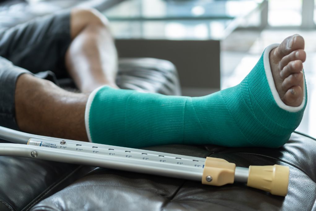 Fracture vs Break Is There a Difference