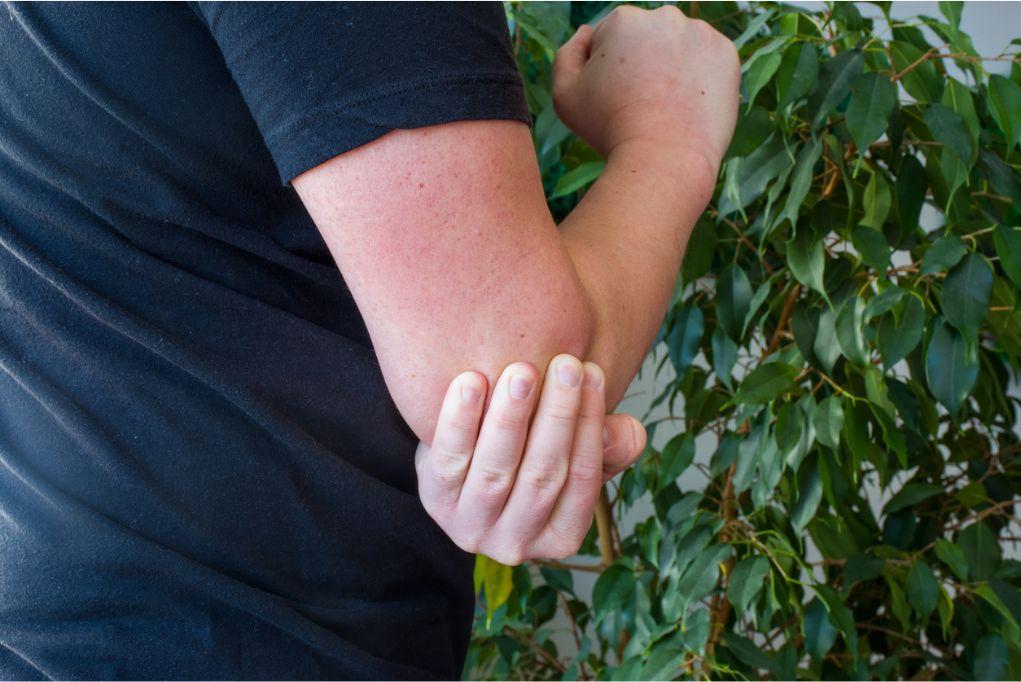 How To Treat Tricep Tendonitis And Regain Strength